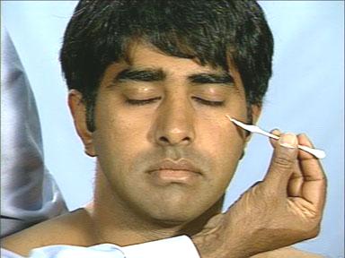 Neurology OSCE Exam